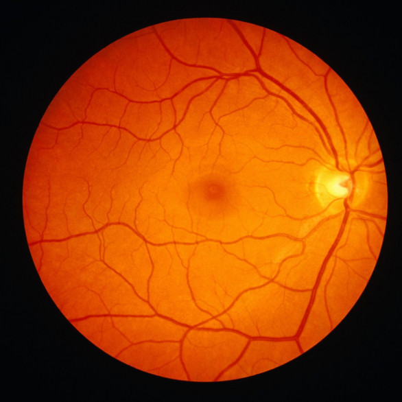 Retinal Imaging / Photography 视网膜照相